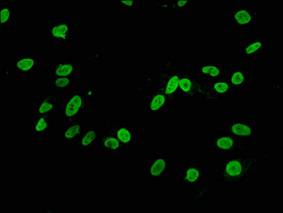 Di-methyl-Histone H3.1（K4）Antibody