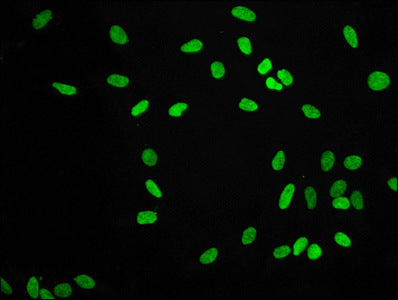Di-methyl-Histone H3.1（K9）Antibody