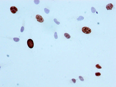 Phospho-Histone H3.1（S10）Antibody