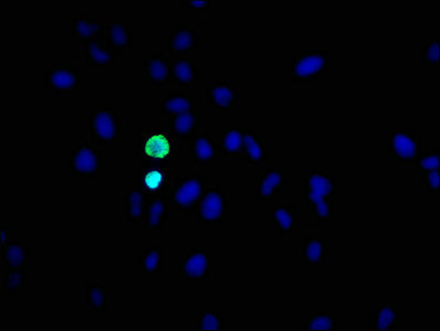 Phospho-Histone H3.1（S10）Antibody