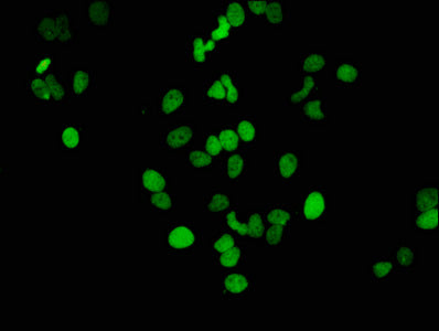 Acetyl-Histone H3.1（K14）Antibody