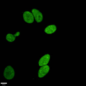 Mono-methyl-Histone H3.1（R17）Antibody