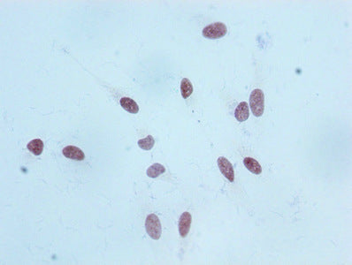 Mono-methyl-Histone H3.1（K18）Antibody