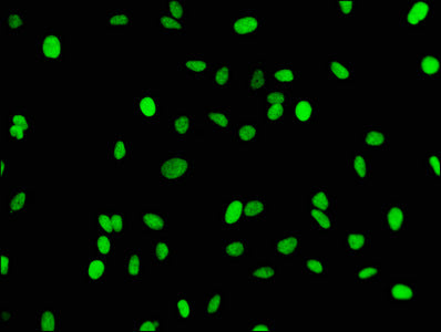 Mono-methyl-Histone H3.1（K18）Antibody