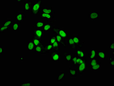 Mono-methyl-Histone H3.1（K36）Antibody