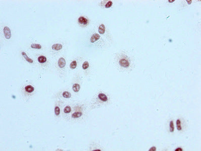 Acetyl-Histone H3.1 (K56) Antibody