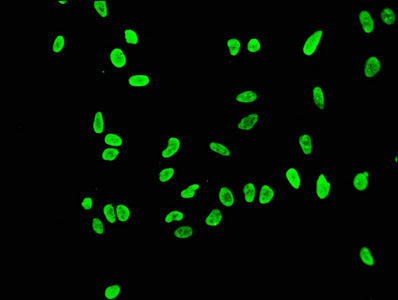 Acetyl-Histone H3.1 (K56) Antibody