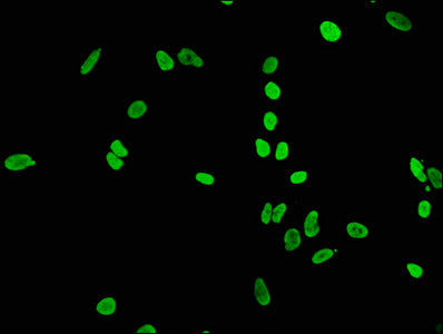 Acetyl-Histone H4 (K5) Antibody