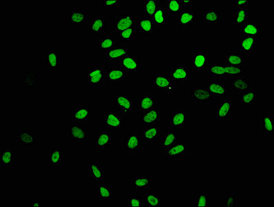 Acetyl-Histone H4 (K16) Antibody