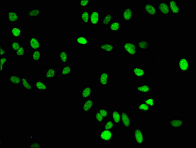 Mono-methyl-Histone H4 (K16) Antibody