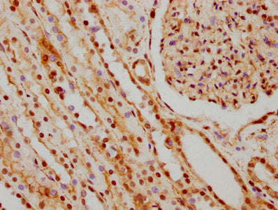 HNRNPC Antibody