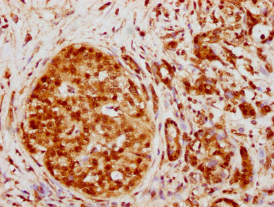 HNRNPK Antibody
