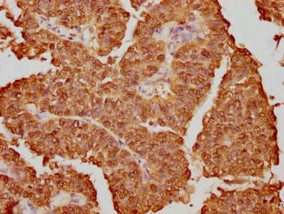 HNRNPK Antibody