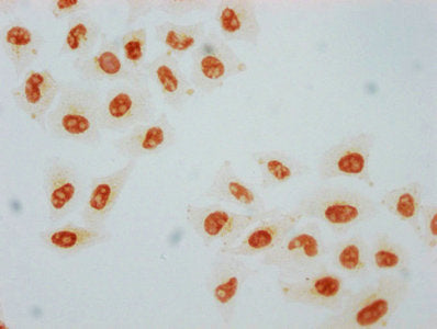 Phospho-HSF1 (S326) Antibody