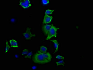 HSPB1 Antibody