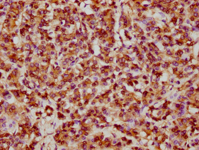 HSPB1 Antibody