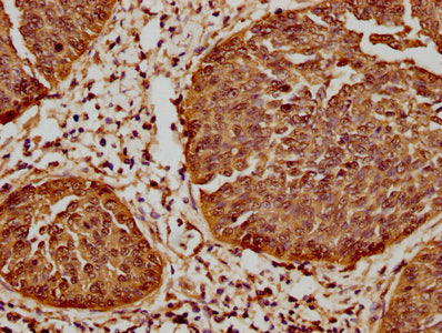 HSPB1 Antibody