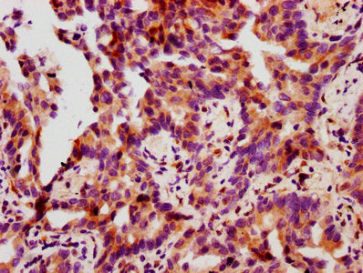 Phospho-HSPB1 (S78) Antibody