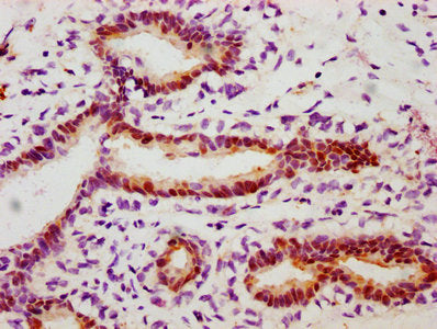 Phospho-HSPB1 (S78) Antibody