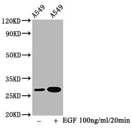 Phospho-HSPB1 (S78) Antibody