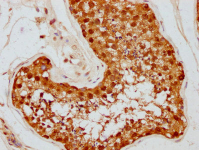 HSP90AA1 Antibody