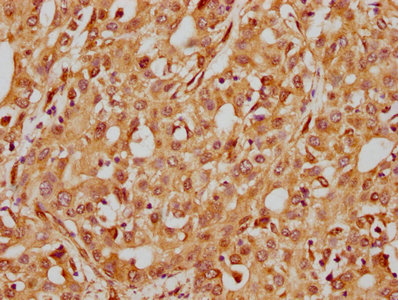 ITGB1 Antibody