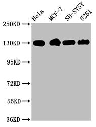 ITGB1 Recombinant Monoclonal Antibody
