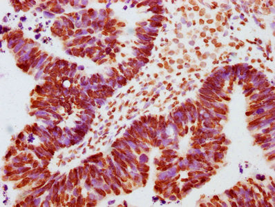 Phospho-JAK2 (Y1007 + Y1008) Antibody
