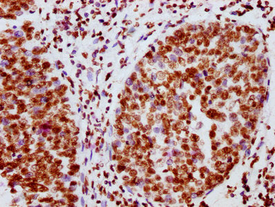 Phospho-JAK2 (Y1007 + Y1008) Antibody