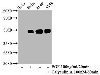 Phospho-JUN (S63) Antibody