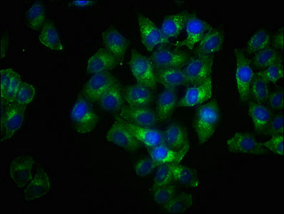 Phospho-LAT (Y191) Antibody