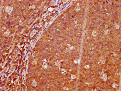 Phospho-LAT (Y191) Antibody