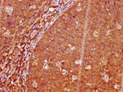 Phospho-LAT (Y191) Antibody