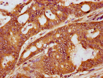 Phospho-LAT (Y191) Antibody
