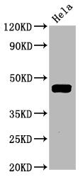 Phospho-MAP2K1 (T292) Recombinant Monoclonal Antibody