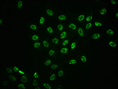 Phospho-MAPK3 (T202) + MAPK1 (T185) Antibody