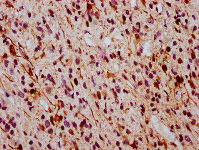 Phospho-MAPK3 (T202) + MAPK1 (T185) Antibody