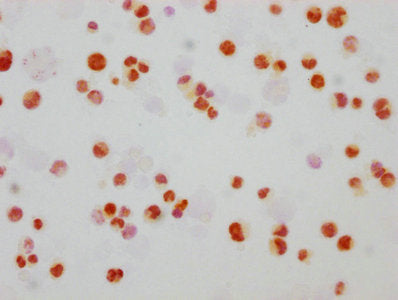 Phospho-MAPK8/MAPK9/MAPK10 (T183/T183/T221) Antibody