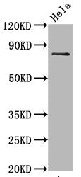 Phospho-MAPT (S396) Recombinant Monoclonal Antibody