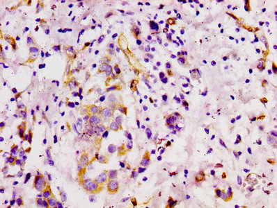 CD146 Antibody