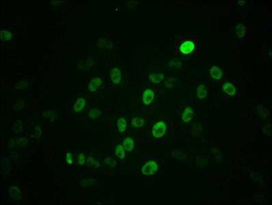 Phospho-MYC (S62) Antibody