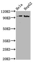 Phospho-NBN (S343) Recombinant Monoclonal Antibody