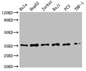 NFKBIA Recombinant Monoclonal Antibody