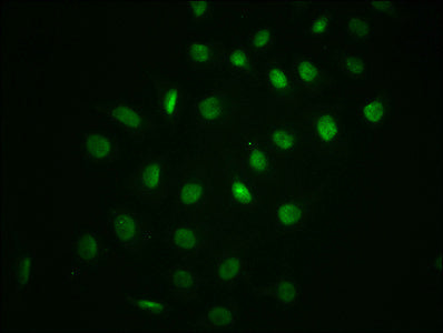 Phospho-NFKBIA (S32) Antibody