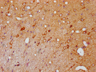 Phospho-PAK1/PAK2/PAK3 (S144+S141+S139) Antibody