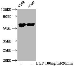 Phospho-PAK1/PAK2/PAK3 (S144+S141+S139) Recombinant Monoclonal Antibody