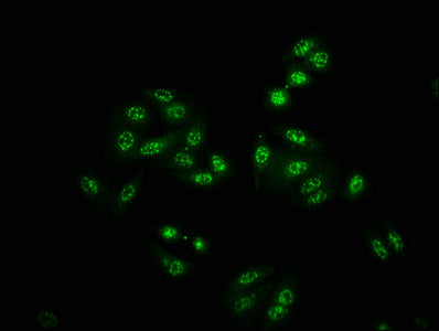 Phospho-PAK4/PAK5/PAK6 (S474/S560/S602) Antibody