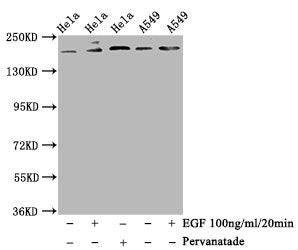 Phospho-PDGFRB (Y740) Recombinant Monoclonal Antibody