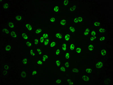 Phospho-POLR2A (S2) Antibody