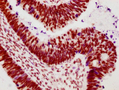 Phospho-POLR2A (S2) Antibody